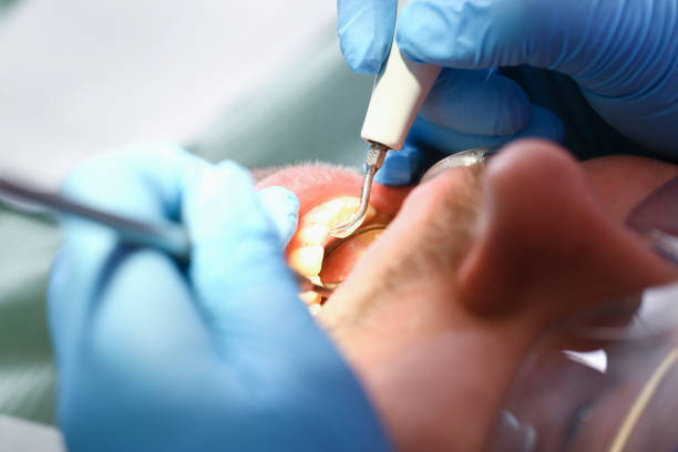 Best Emergency Treatment for Dental Infections or Abscesses in Raymond, WI