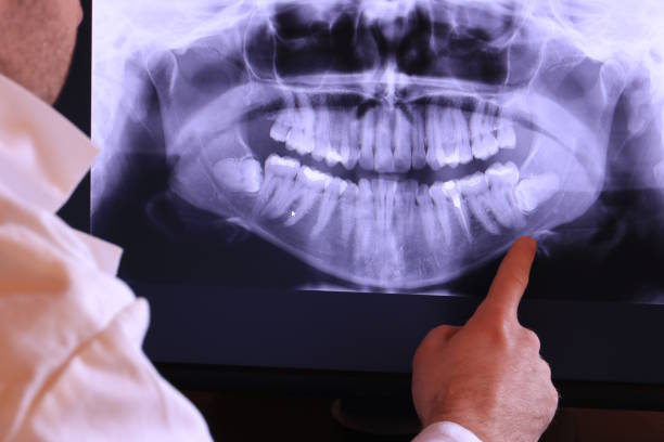 Best Emergency Denture Repair in Raymond, WI