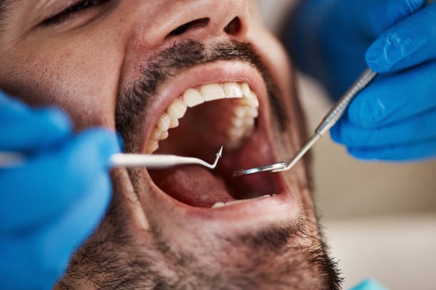 Best Emergency Dental Care for Broken or Chipped Teeth in Raymond, WI
